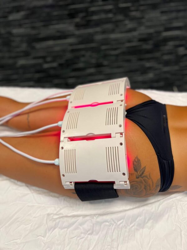 Lipolaser - Image 4