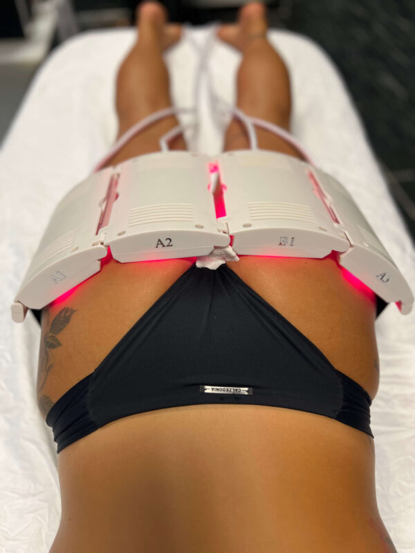 Lipolaser - Image 2